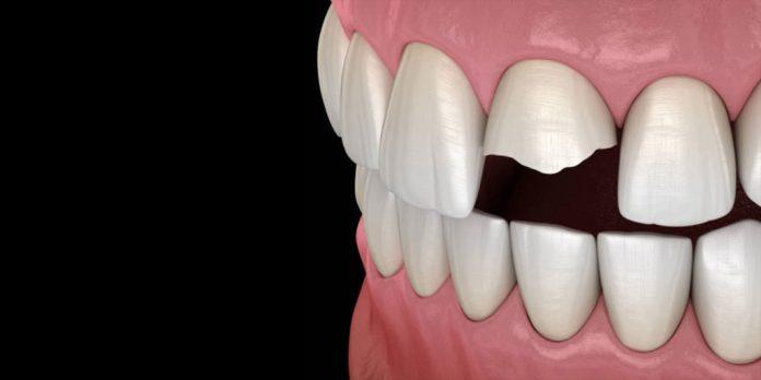Baton Rouge Cosmetic Dentist Transforming Smiles with Precision and Care