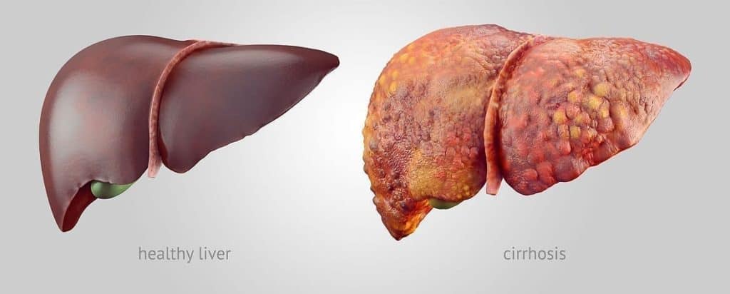 medical-oncologist in-bangalore-for liver-cancer