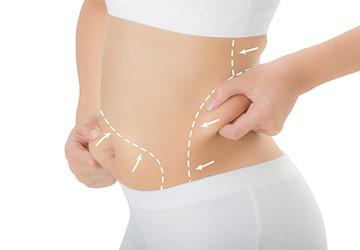 liposuction-new-1
