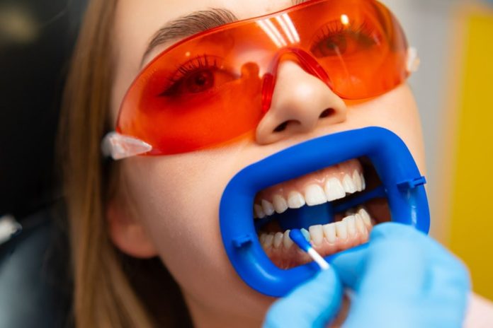 lady getting teeth whitening with sensitivity in teeth