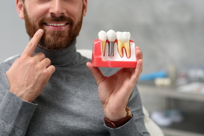how dental implants can preserve your jawbone and why that matters