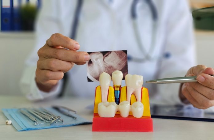 what really happens when you wait too long after losing a tooth