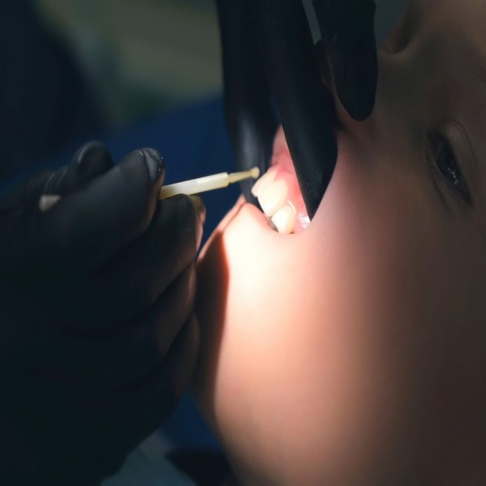 fluoride-treatment-for-kids