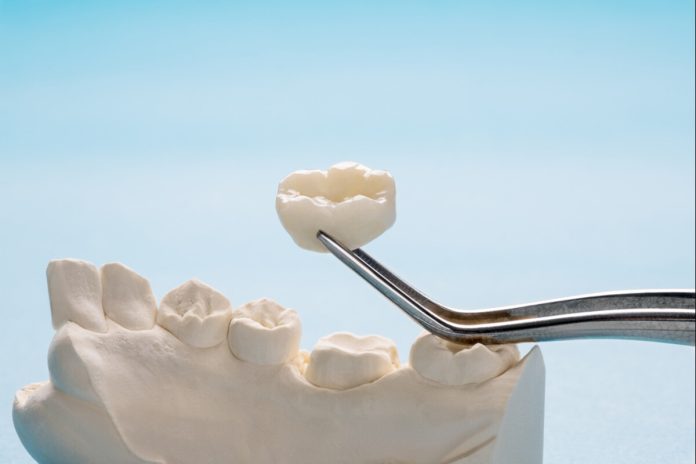 dental crowns in peterborough