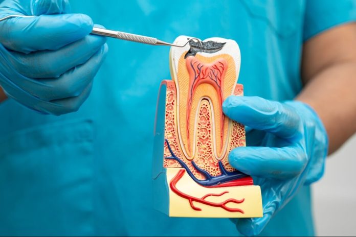 root canal treatment in lloydminster