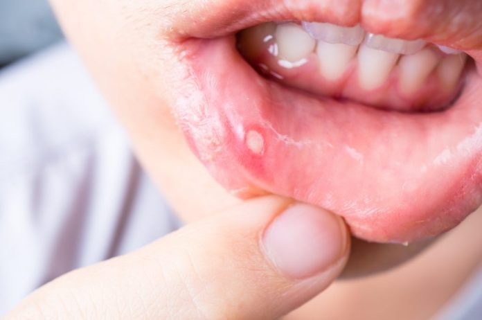 cankers